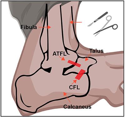 Characterization of pain-related behaviors and gene expression profiling of peripheral sensory ganglia in a mouse model of acute ankle sprain